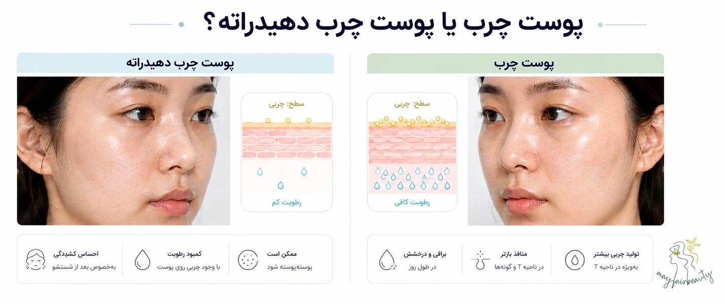 تفاوت پوست چرب و پوست چرب دهیدراته